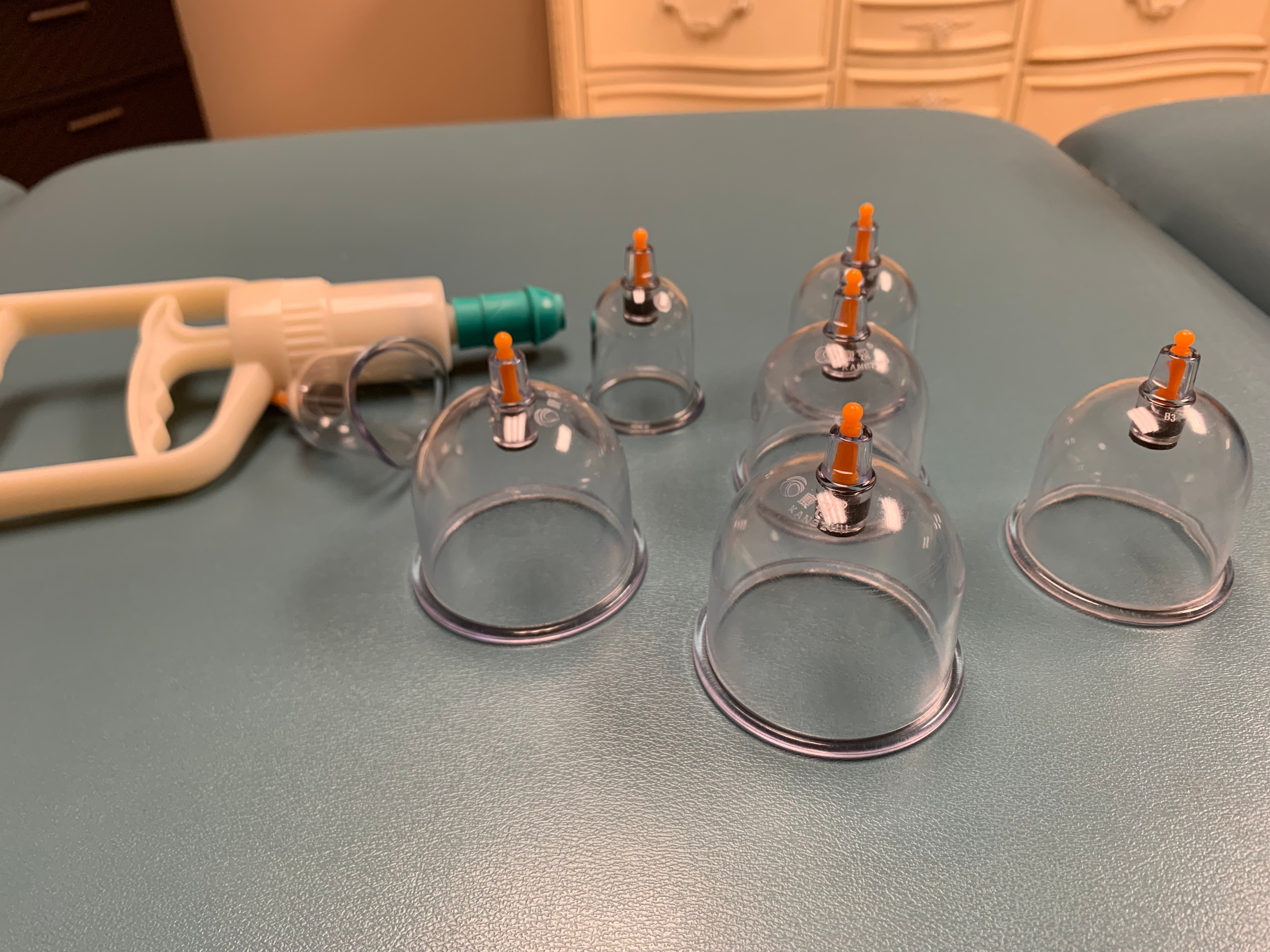 5-benefits-of-cupping-you-need-to-know